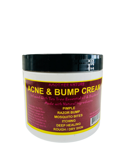 Acne & Bump Cream