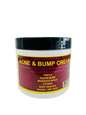 Acne & Bump Cream